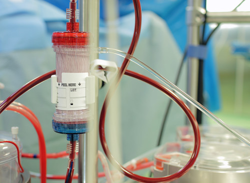 Filtres de dialyse